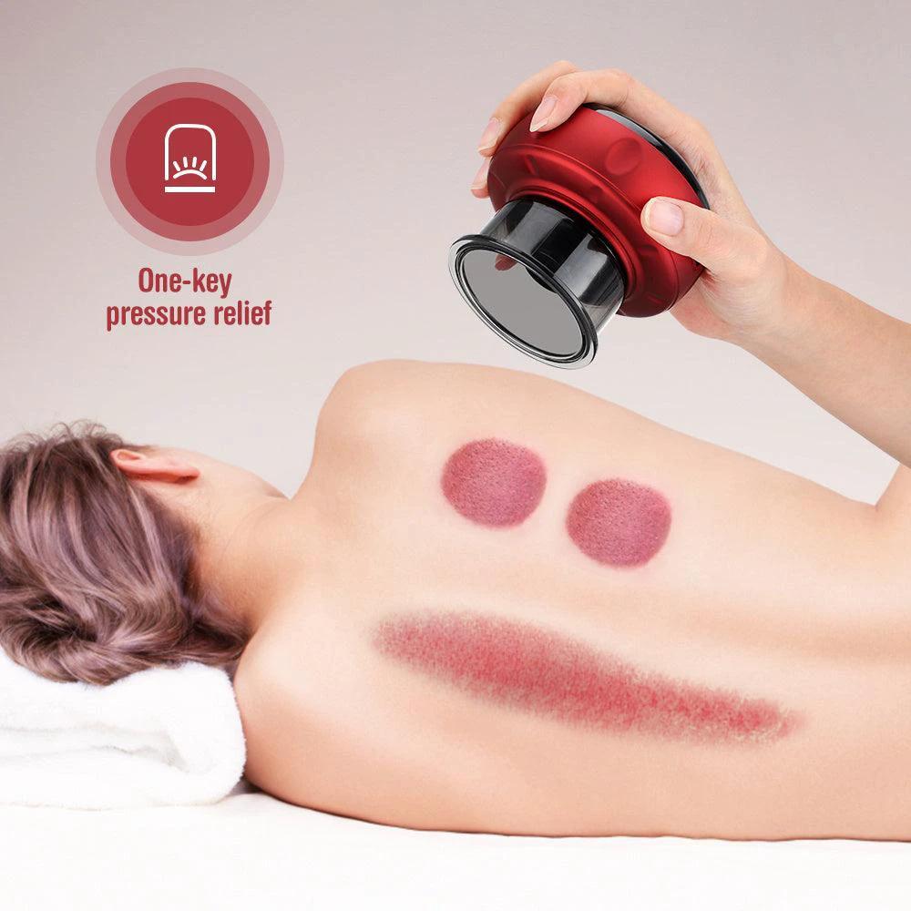 Electric Cupping Massage Device | State-of-the-Art Vacuum Therapy